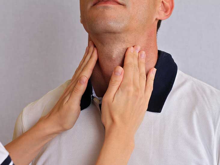 Thyroid disorders in expats